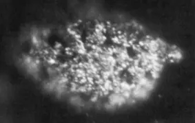A grainy black-and-white close-up of a rough, pale, crumbly-looking lump on a dark background