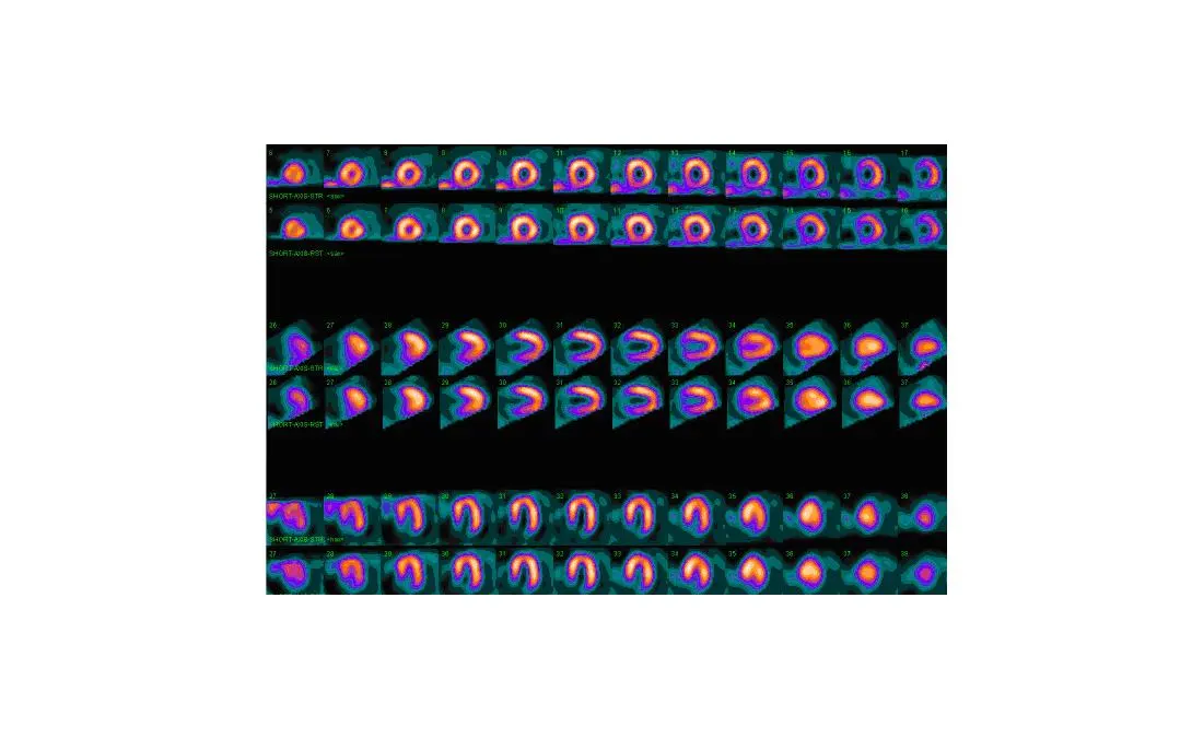 Rows of small rings and horseshoe shapes glowing purple, orange and yellow on a black background, each a slice through the heart’s main pumping chamber