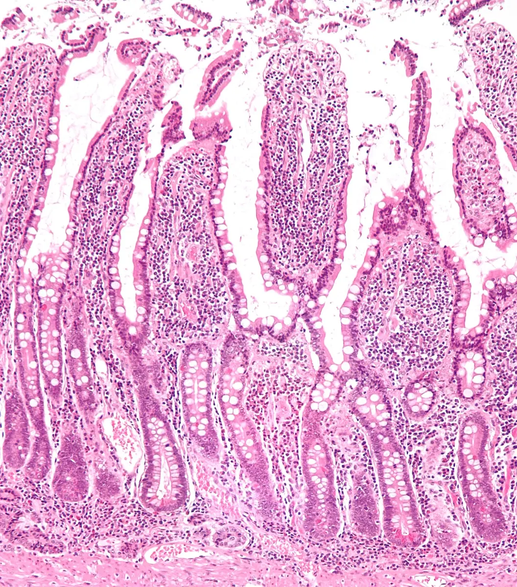 A pink and purple stained slice of tissue under a microscope, with many long finger-like shapes pointing up side by side