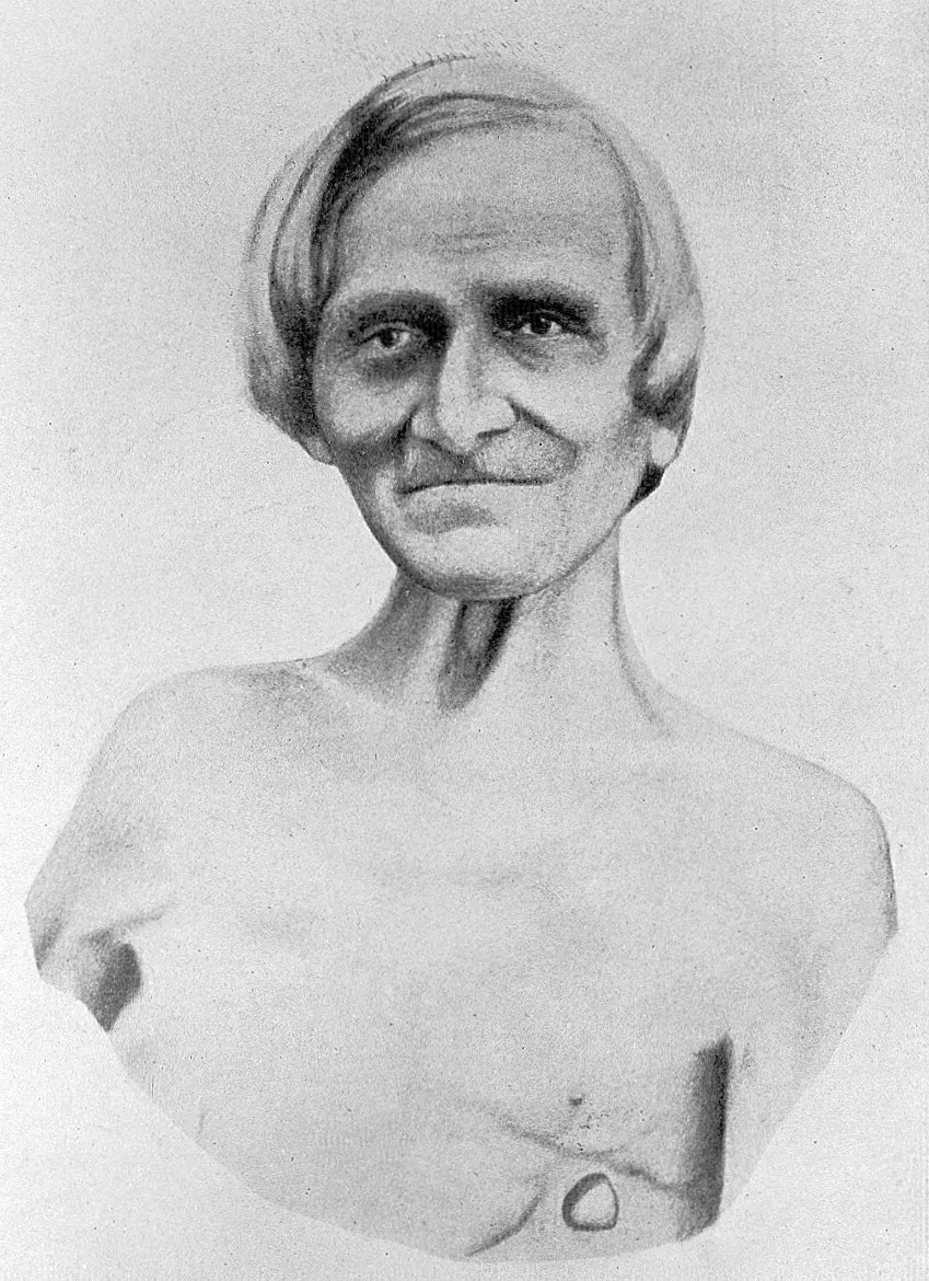 A drawing of an old man with long hair and a gentle smile, bare-chested, with a round scar and a small hole low on the left side of his chest