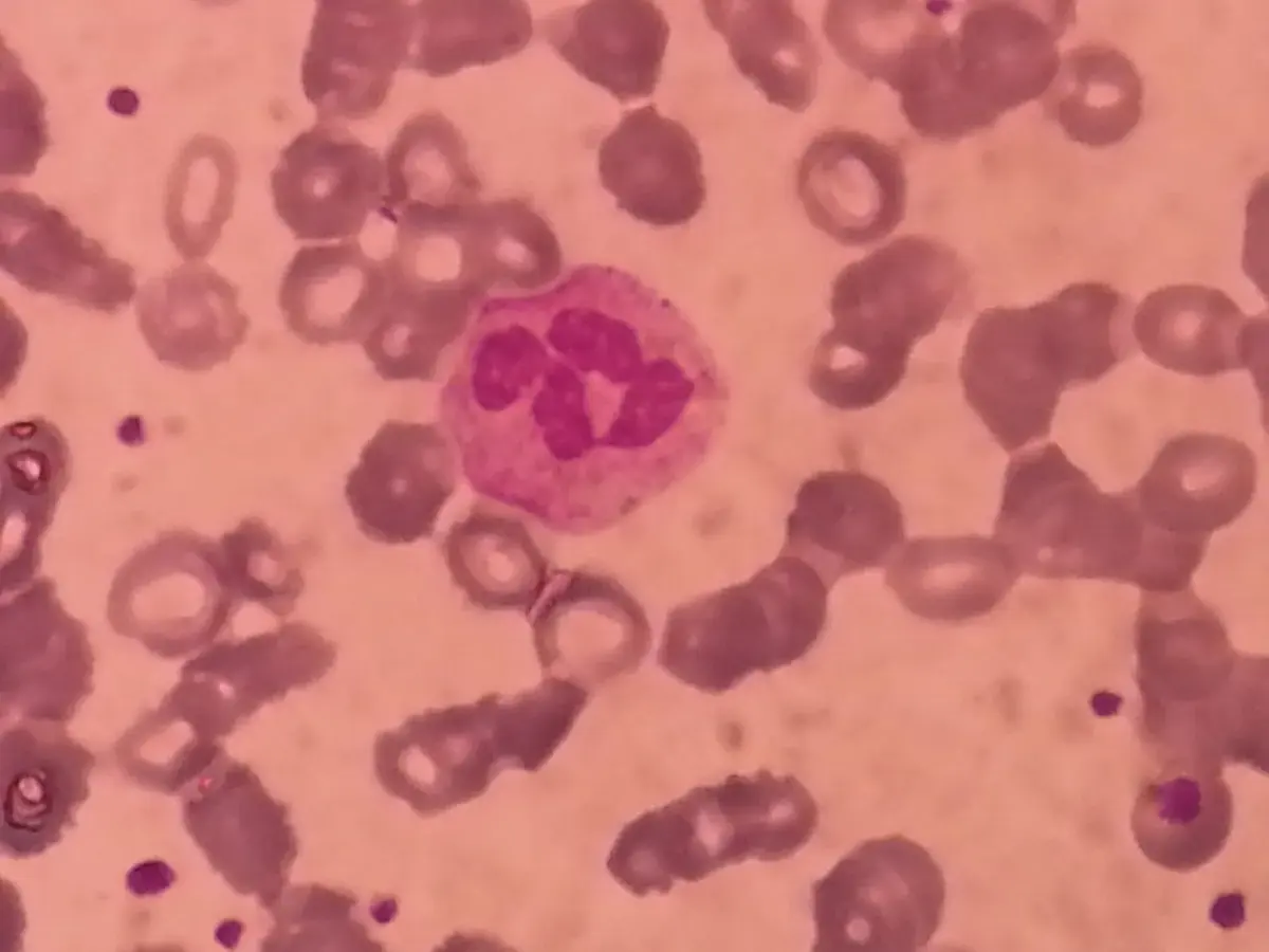 A microscope view of stained blood: many pink round red blood cells, one larger cell with a purple lobed nucleus in the middle, and small purple dots between the cells