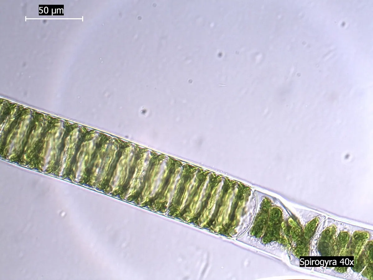 A long green thread seen under a microscope, divided into cells, each with a green ribbon twisted in a spiral inside