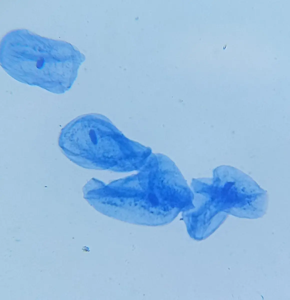 Flat, irregular, pale blue cells with dark blue dots in their middles, seen through a microscope