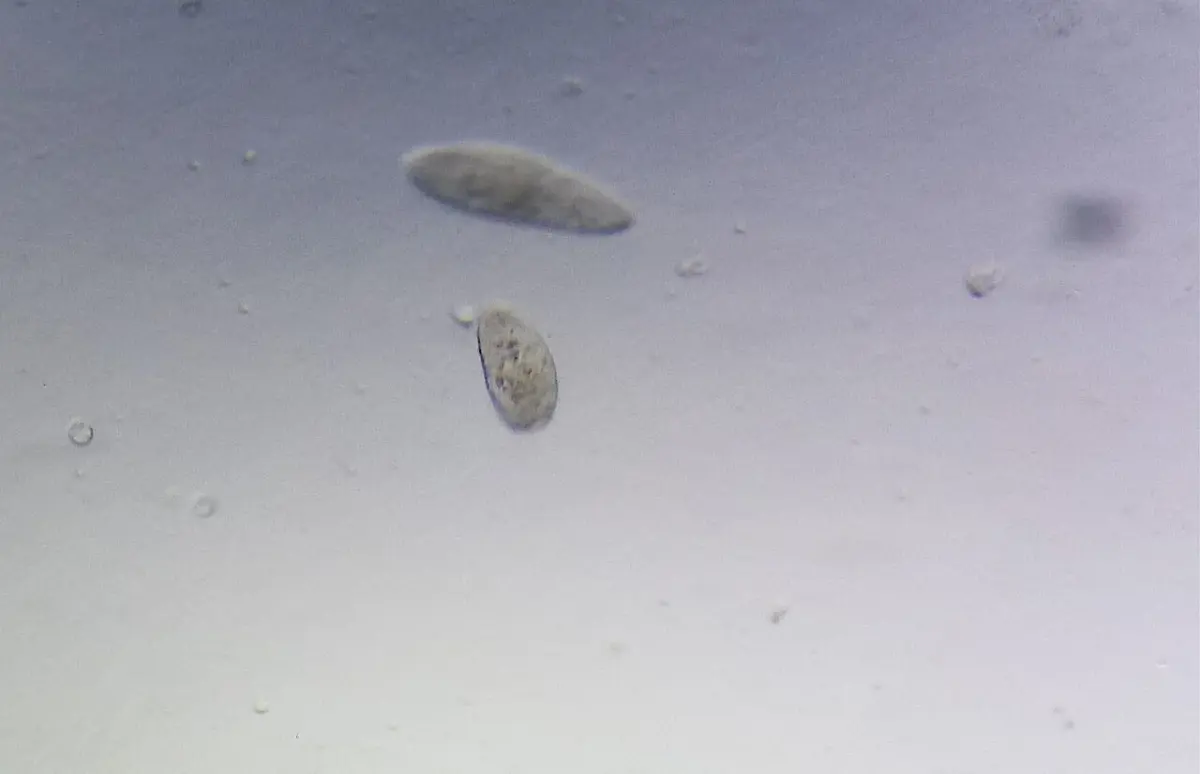 Two small, pale, slipper-shaped cells on a gray background, seen through a microscope