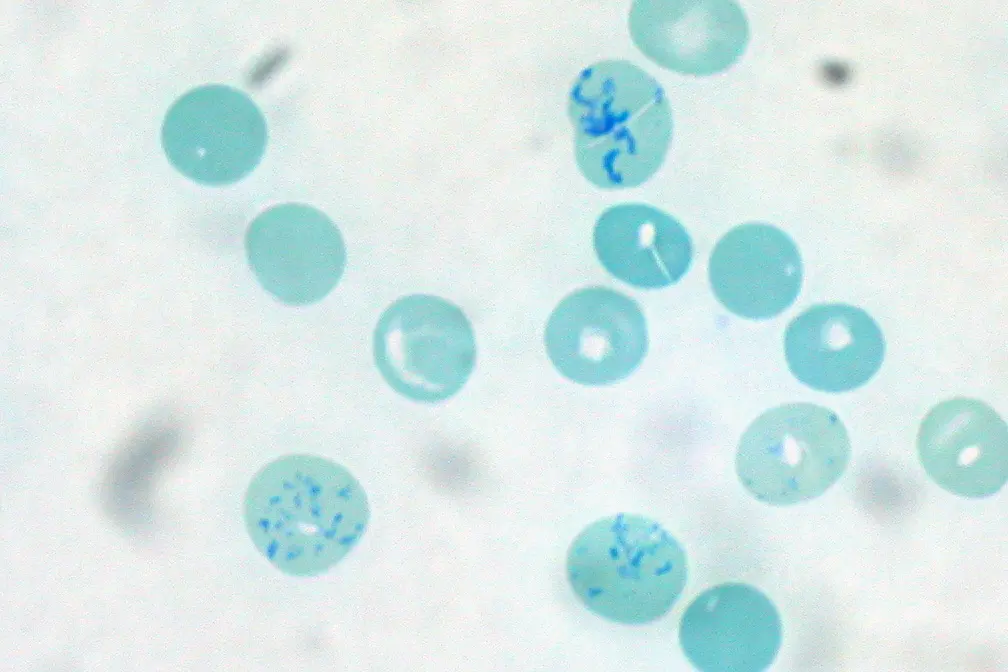 Pale blue round blood cells under a microscope; three of them have dark blue threads and dots inside