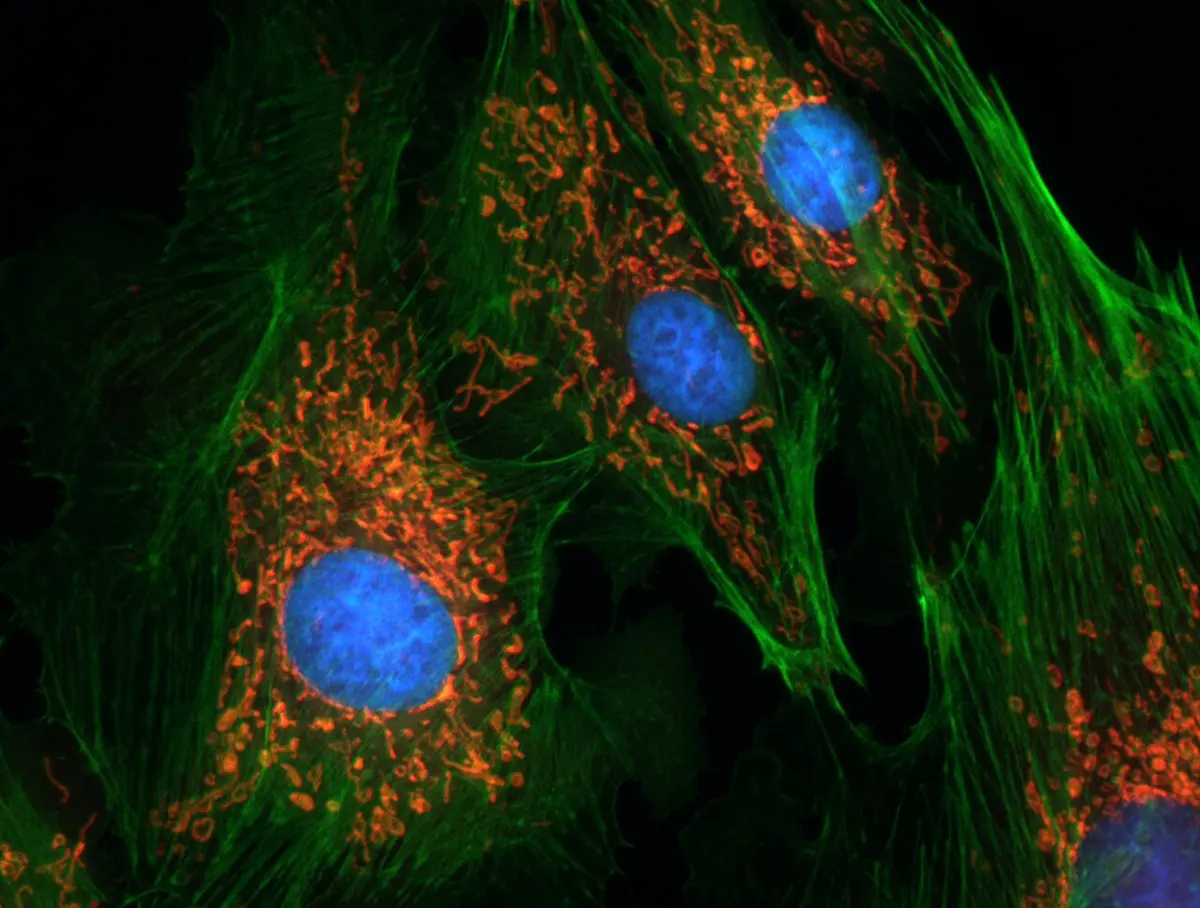 Several cells on a black background: a blue oval in each, surrounded by red dots and threads and a web of green fibers