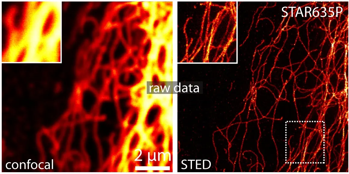 Two views of the same tangle of glowing orange-red threads on black: on the left, thick fuzzy bands; on the right, the same area as many fine separate threads