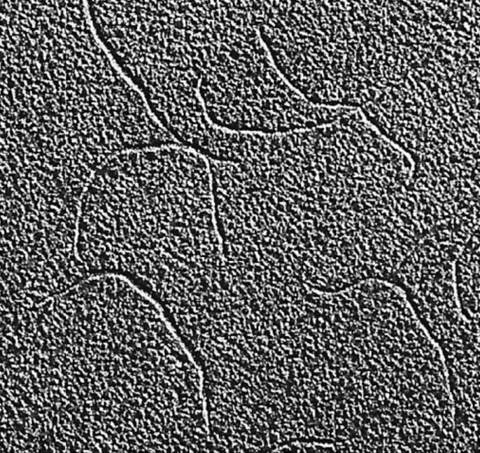 A black-and-white electron microscope picture of long, thin, wavy threads crossing each other on a pale background