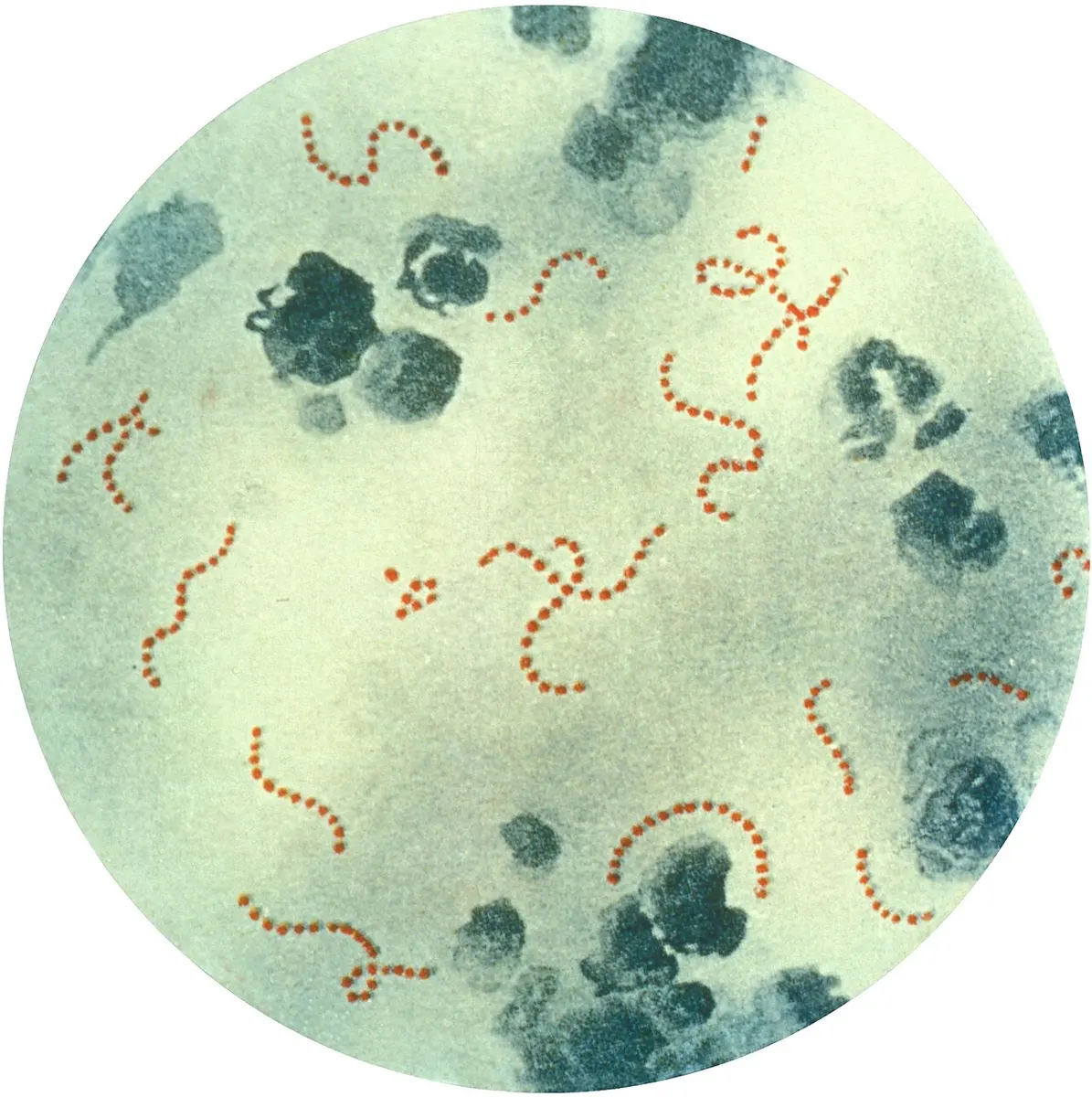 A round microscope view on a pale blue-green background: many tiny red dots joined in curly chains, among larger dark blue blobs