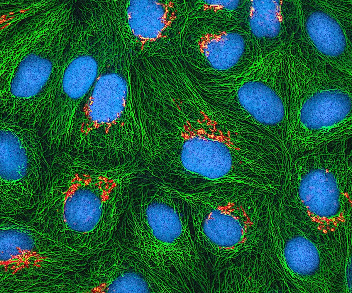 Many human cells seen under a microscope: oval cyan nuclei, a dense web of green threads around them, and small orange clusters beside each nucleus