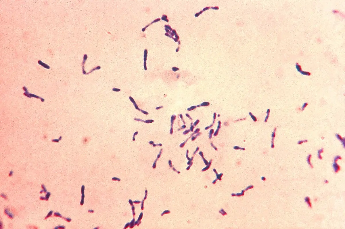 A microscope view of many thin purple rod-shaped bacteria, some straight and some slightly curved or club-shaped, scattered on a pale pink background