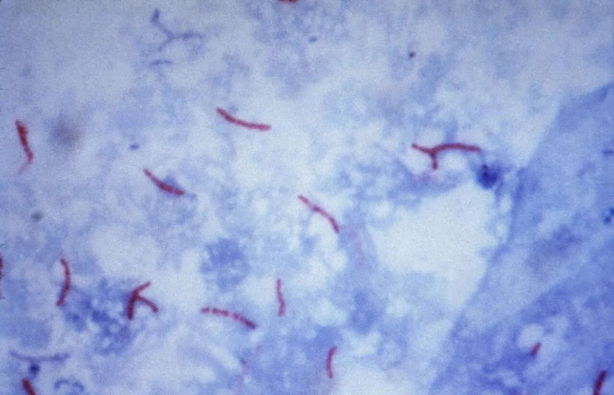 A microscope view with a pale blue background scattered with thin, slightly curved red rods, some single and some in small groups