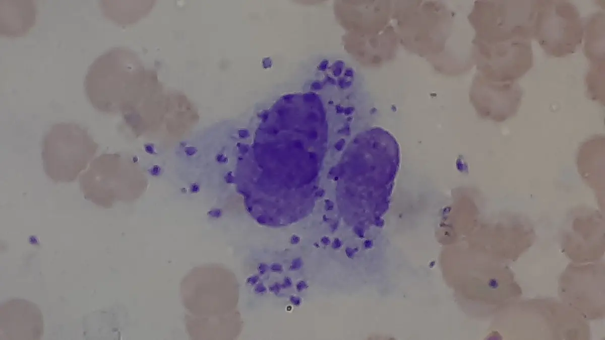 A microscope view of a large purple cell with two dark purple nuclei, surrounded by dozens of tiny dark purple oval dots, with pale pink red blood cells around it
