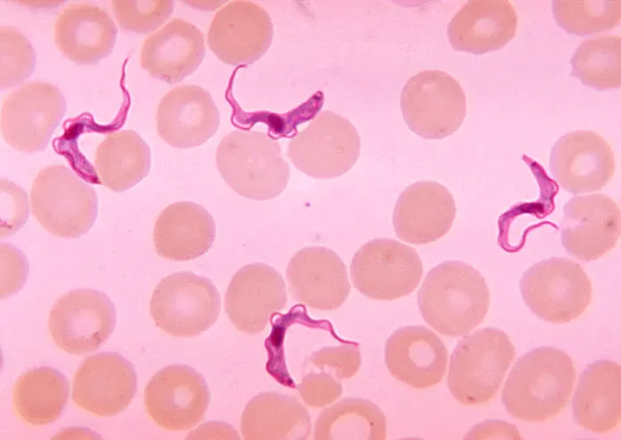 A microscope view of pale orange-pink round red blood cells with four long, wavy, dark pink cells twisting between them, each with a thin tail