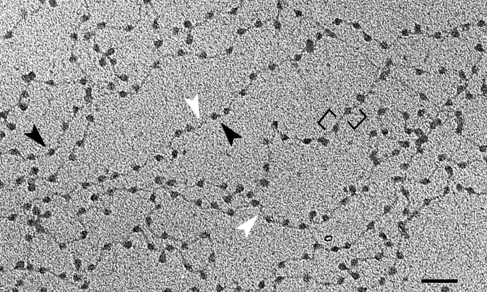 A gray electron microscope picture of thin, winding threads dotted with small dark beads, with arrows pointing to some beads and to the thread between them