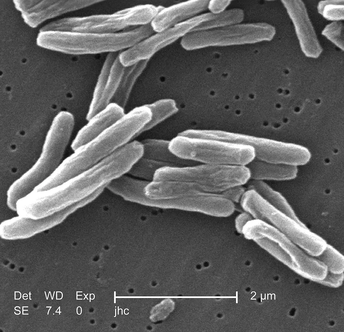 Gray, rod-shaped bacteria lying in clumps, seen through an electron microscope, with a scale bar marked 2 micrometers