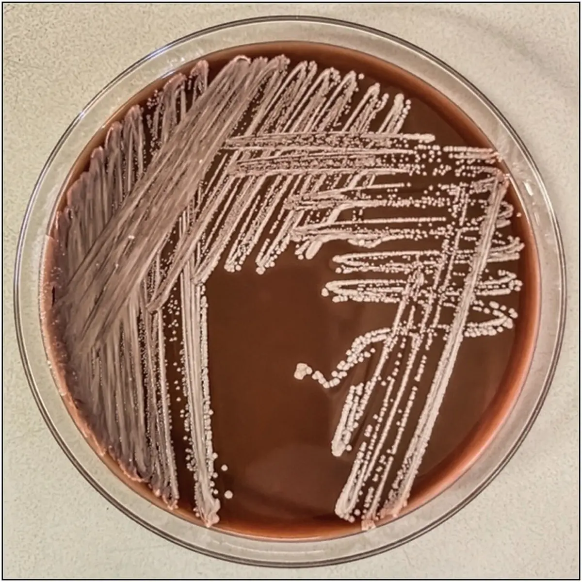 A round dish of brown jelly with criss-cross streaks of a chalky, pinkish-white microbe, breaking up into rows of small round colonies