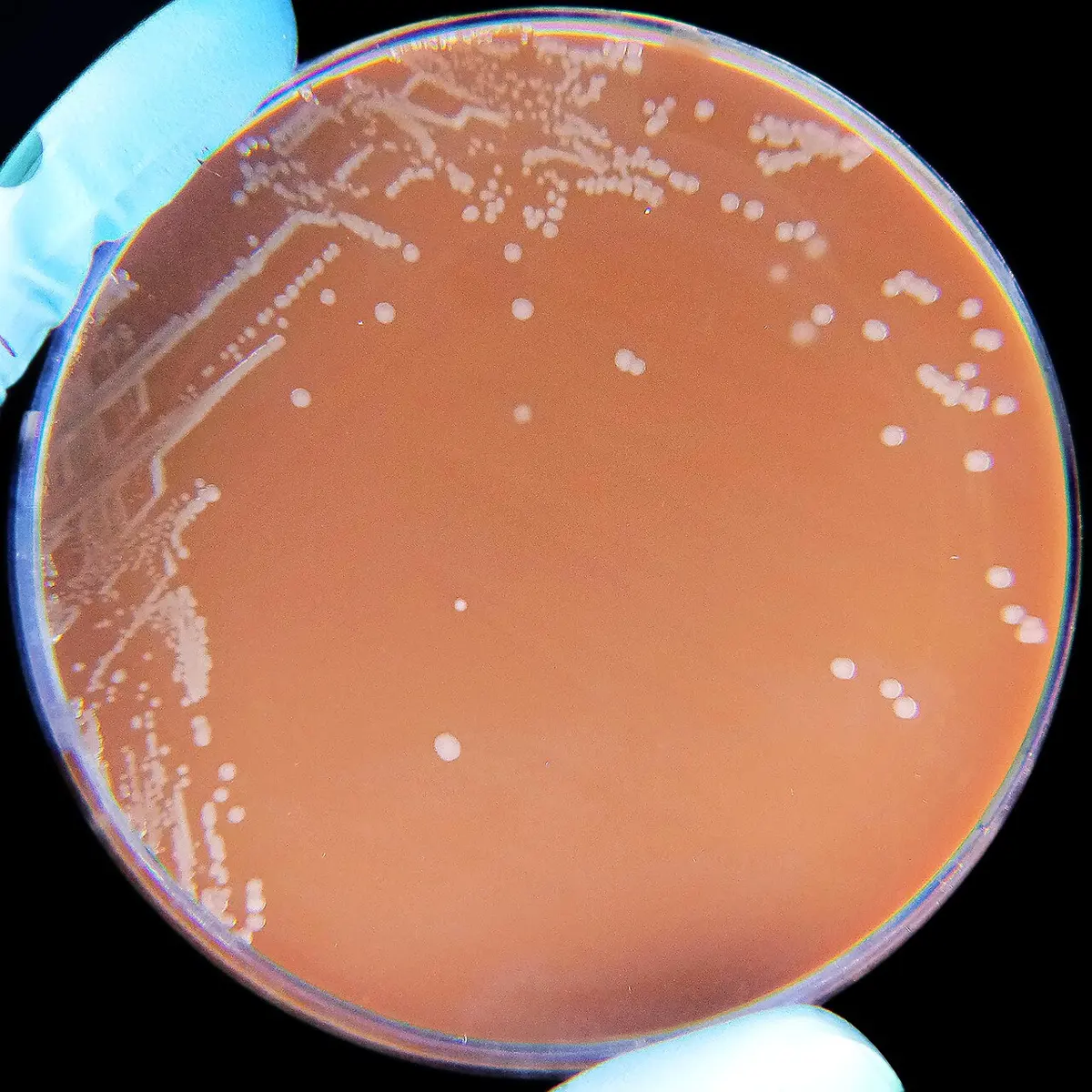 A gloved hand holding a round dish of brown jelly, with streaks and dots of small grayish-white colonies on it