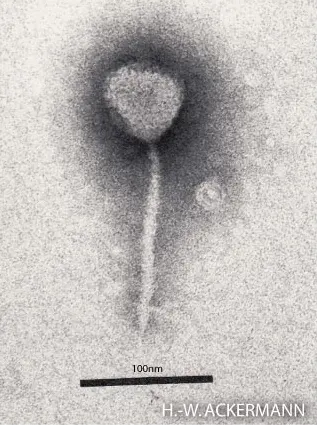 A black-and-white electron microscope picture of one virus particle: a rounded head on top of a long, thin tail, with a scale bar marked 100 nm