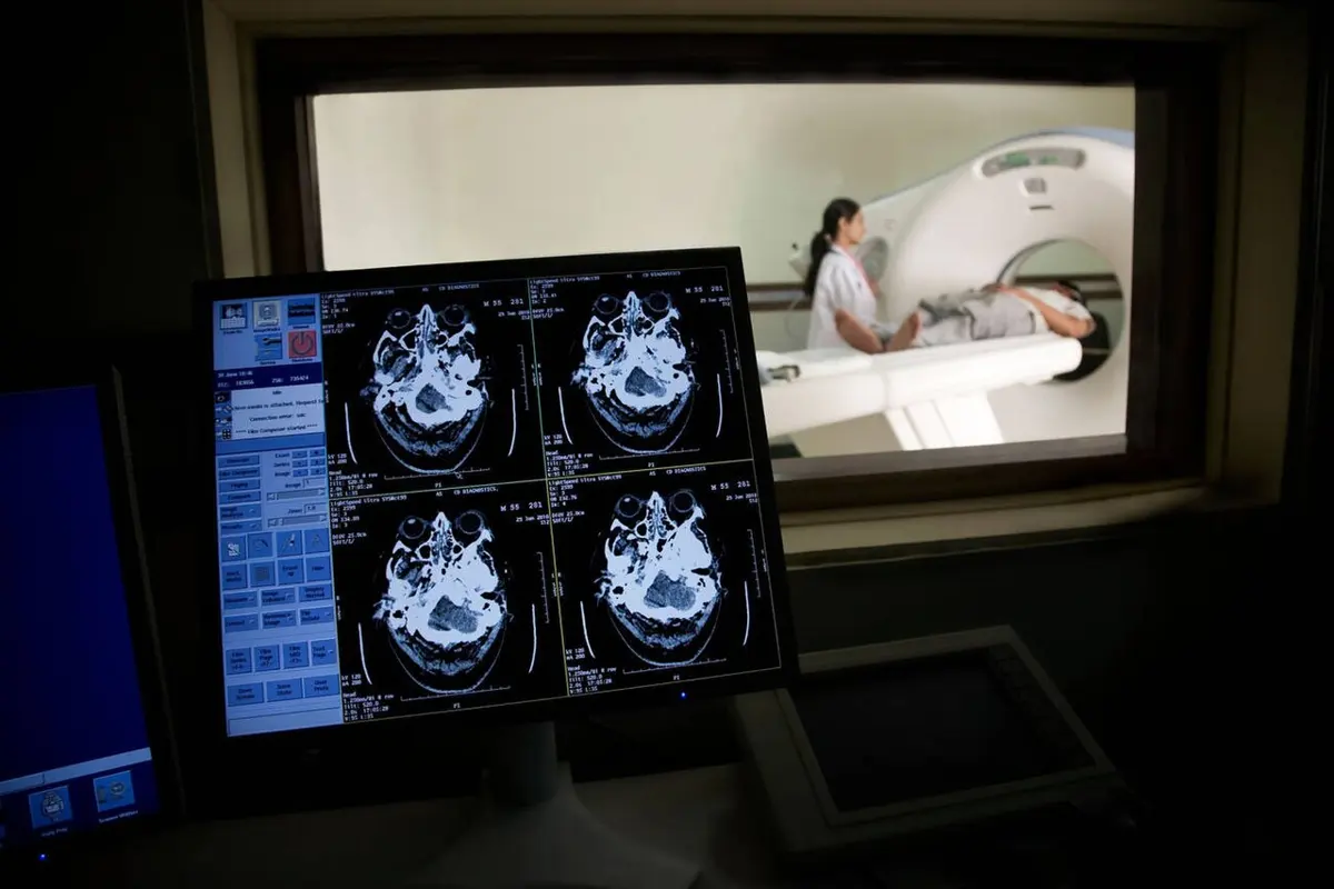 A dim control room with a computer screen showing four gray slices through a head; through a window behind it, a patient lies on a table in a large white ring-shaped machine while a staff member stands beside it