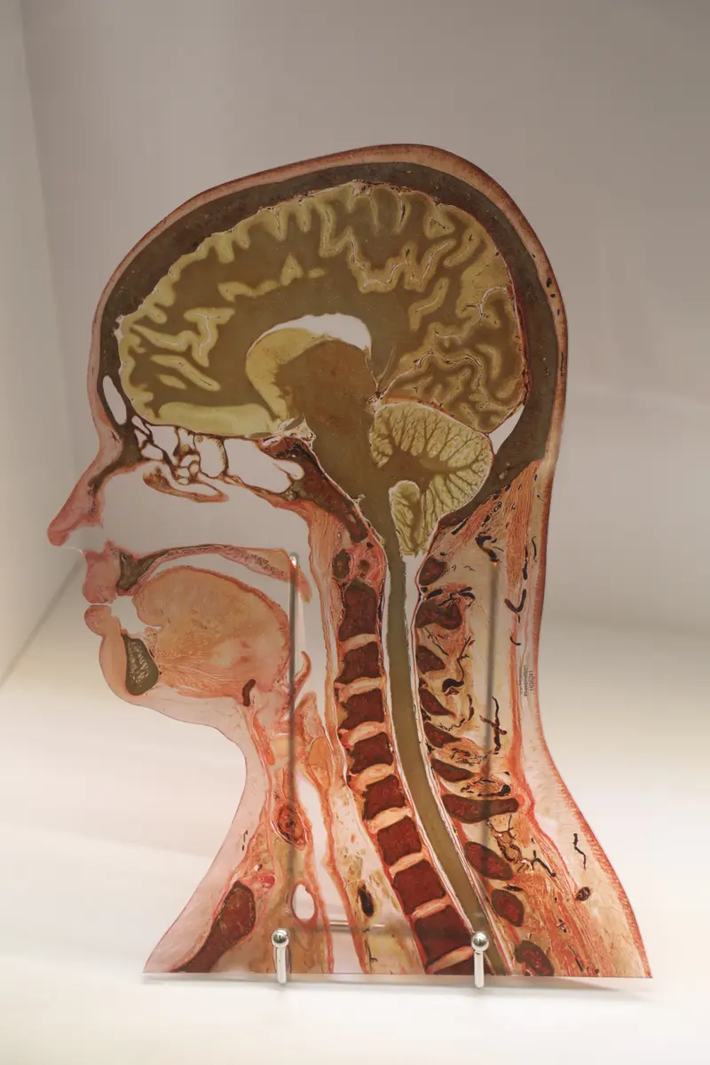 A thin slice through a whole human head, cut down the middle from front to back and mounted upright in a museum, showing the folded brain, a pale curved band below it, the small branched cerebellum at the back and the spinal cord running down the neck