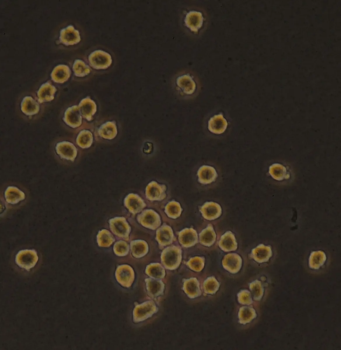 Round, golden-brown cells, each with a darker middle, scattered and clustered on a dark background