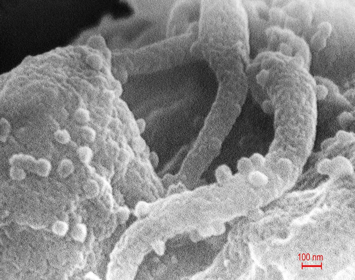 A black-and-white microscope picture of a rough cell surface with long finger-like arms, dotted with many tiny round bumps