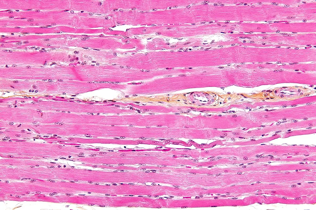 A microscope picture of muscle stained pink: long parallel fibers running across the image, with faint stripes across them and small dark-purple dots of nuclei along their edges. A thin pale-orange strip with small blood vessels runs between the fibers.