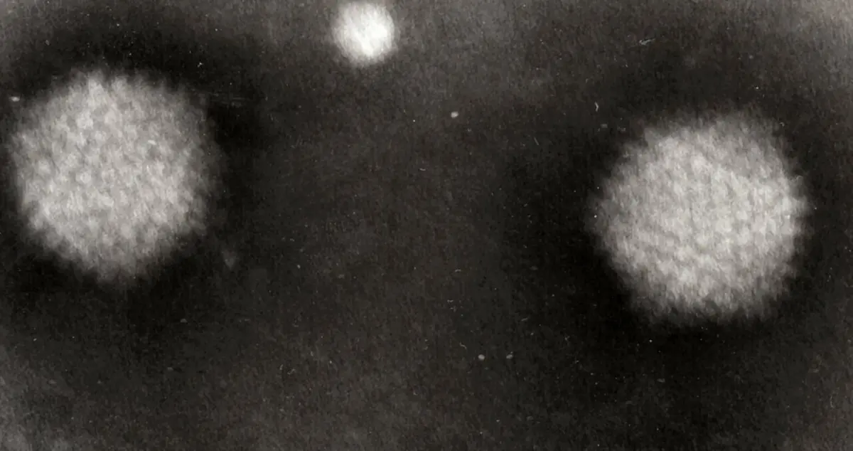 A black-and-white electron microscope picture: two large pale round particles on a dark background, each covered in a fine, regular pattern of tiny bumps