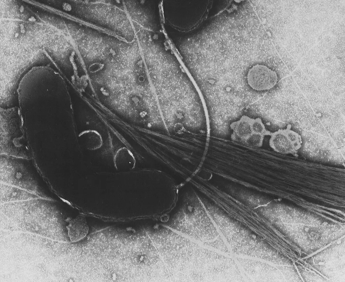 Black and white electron microscope image: a dark, curved, sausage-shaped bacterium with a long whip-like tail, and many thin fibers crossing the picture