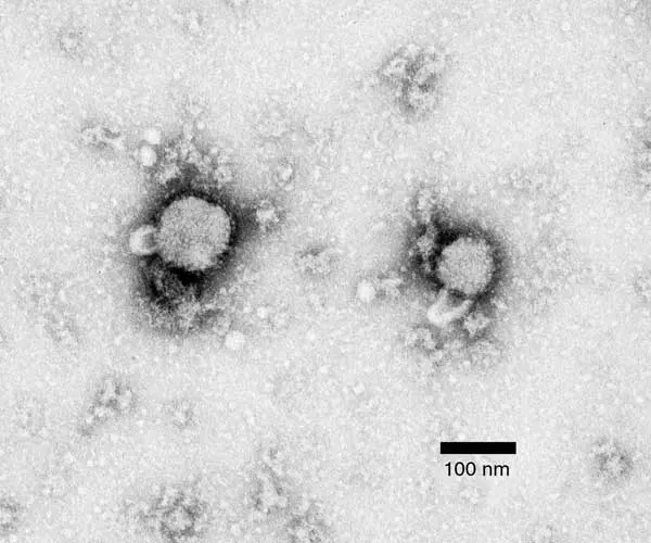 A gray electron microscope picture with two round, dark-edged virus particles with fuzzy outlines, and a black scale bar marked 100 nm