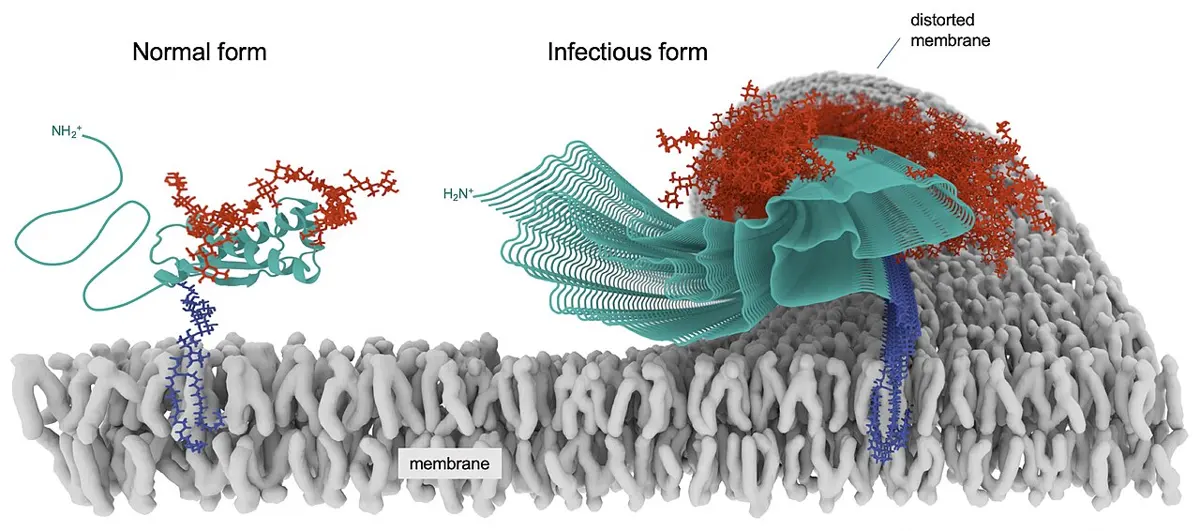 A computer drawing of two proteins on a gray cell membrane: on the left, a single normal prion protein as a loose green ribbon with coils; on the right, many green ribbons stacked into a thick twisted thread that bends the membrane
