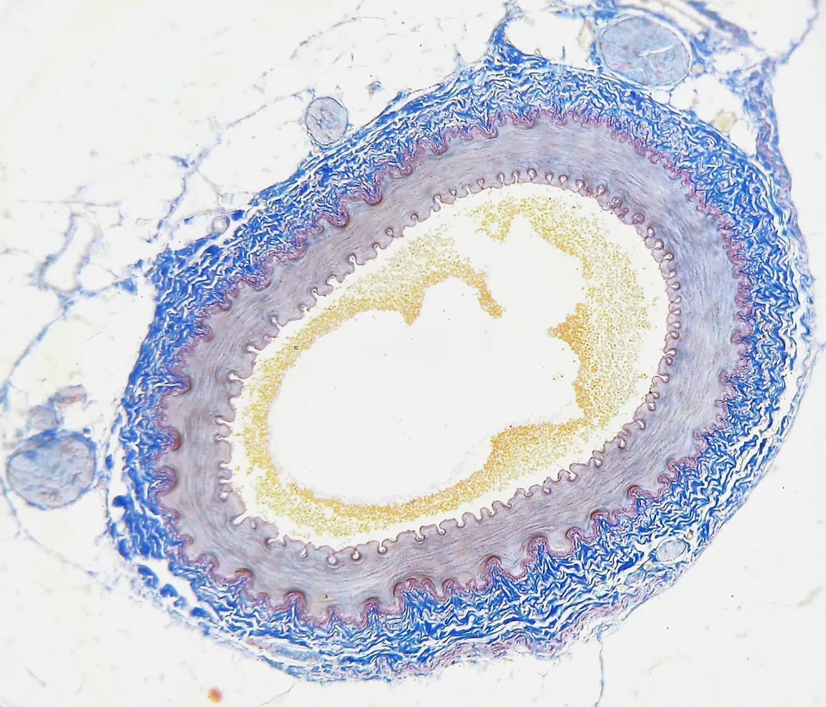 A microscope slide of a cut artery: a pale round space in the middle with a few yellow-orange blood cells, ringed by a wavy purple line, a thick pinkish-gray band, and an outer layer of loose blue fibers