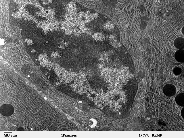 A black-and-white electron microscope picture. A large oval nucleus with blotchy dark and light contents fills the upper left. Around it are many thin, closely packed parallel lines, and on the right several dark round blobs