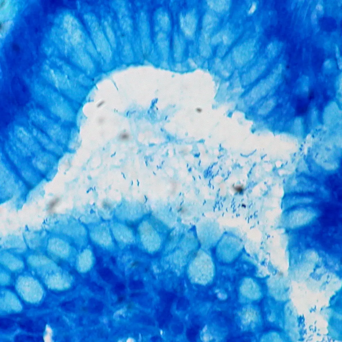A microscope view of stomach tissue stained blue, with rows of cells around a pale space filled with many tiny, dark blue curved rods