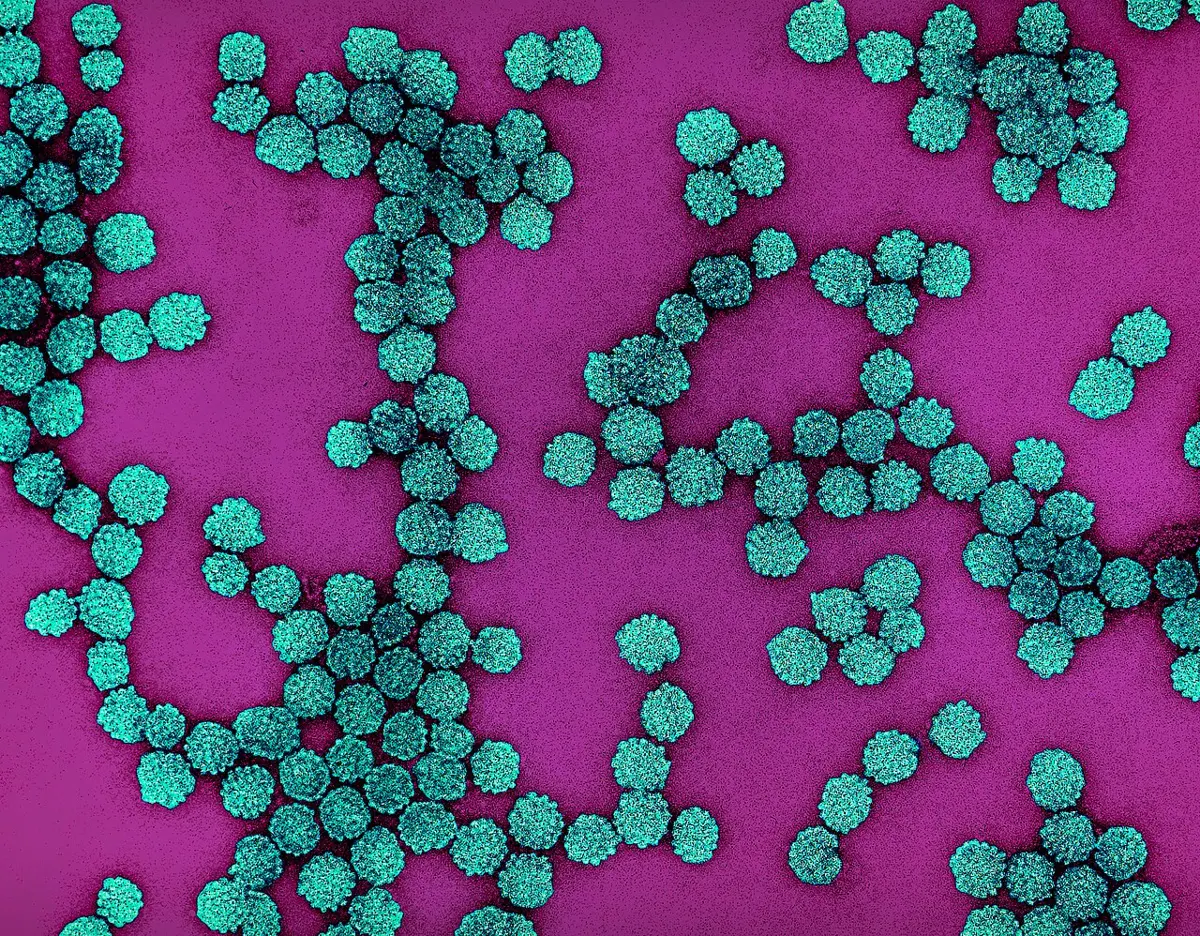 Many tiny round particles, colored teal, clumped together on a pink background