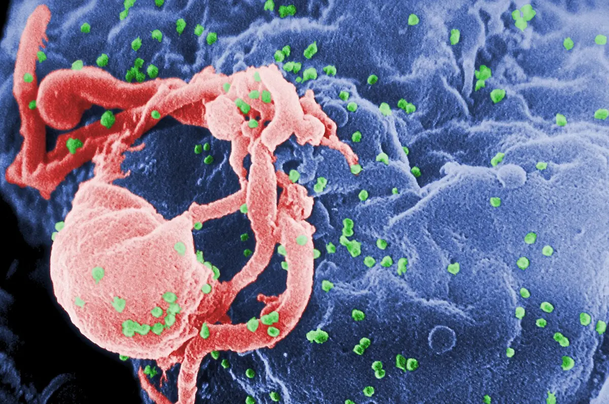 A large rough blue surface with a pink, folded piece of cell membrane, covered in many tiny green balls