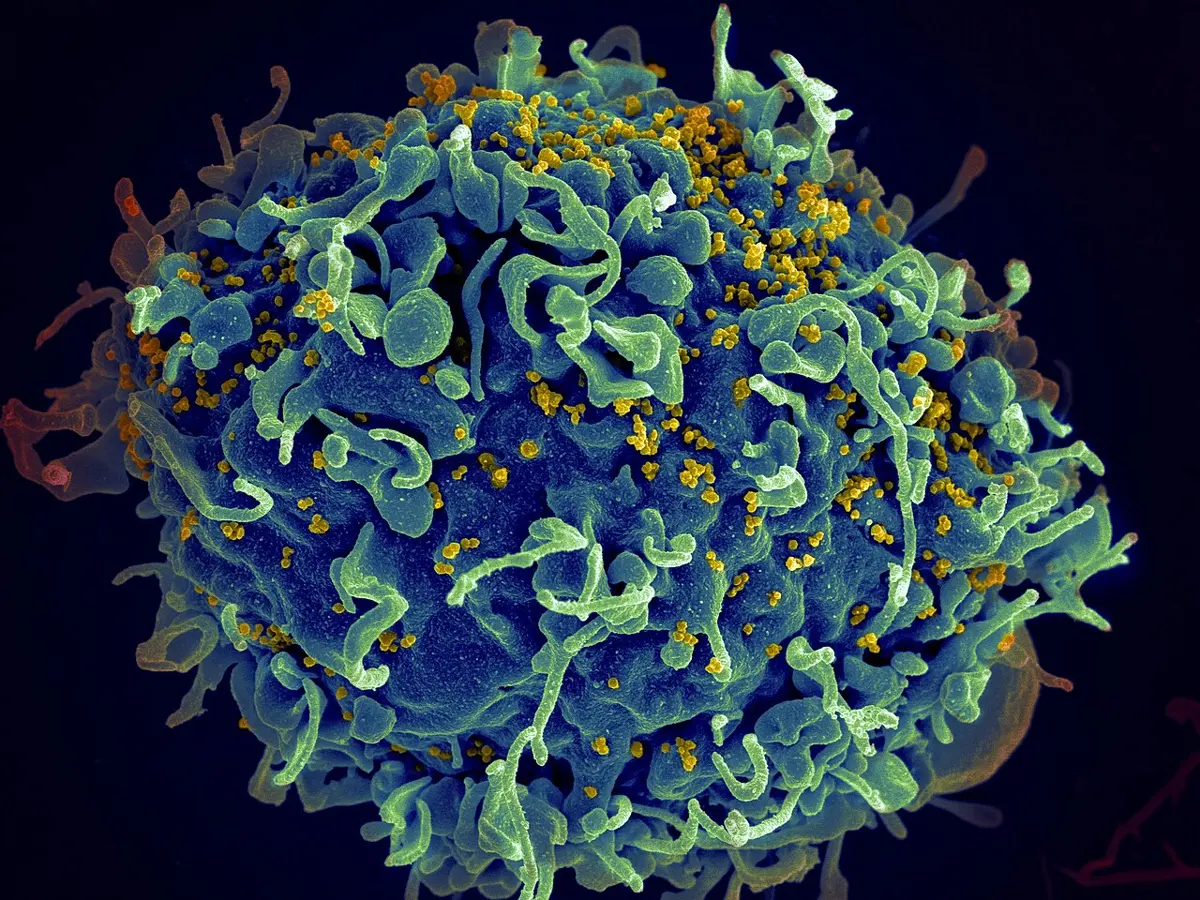 A round cell, colored blue and green, with a rough, frilly surface covered in many tiny yellow dots