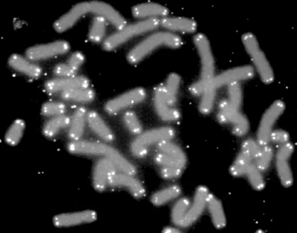 Black-and-white microscope photo of many gray, sausage-shaped chromosomes scattered on a black background, each with small bright white dots at its ends