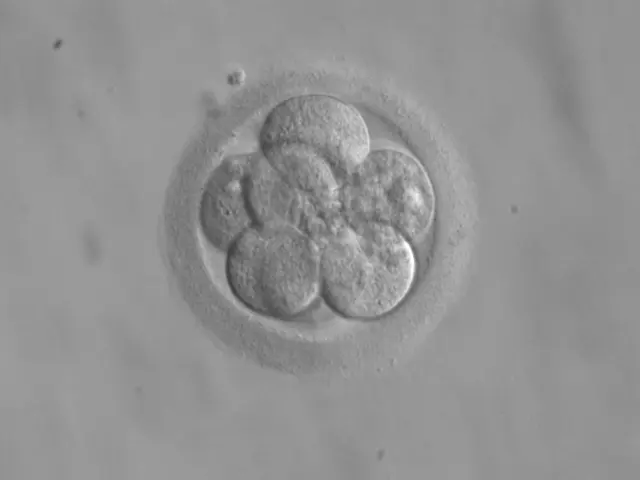 A microscope photo in gray: a round, clear shell containing eight rounded cells packed together like a bunch of grapes
