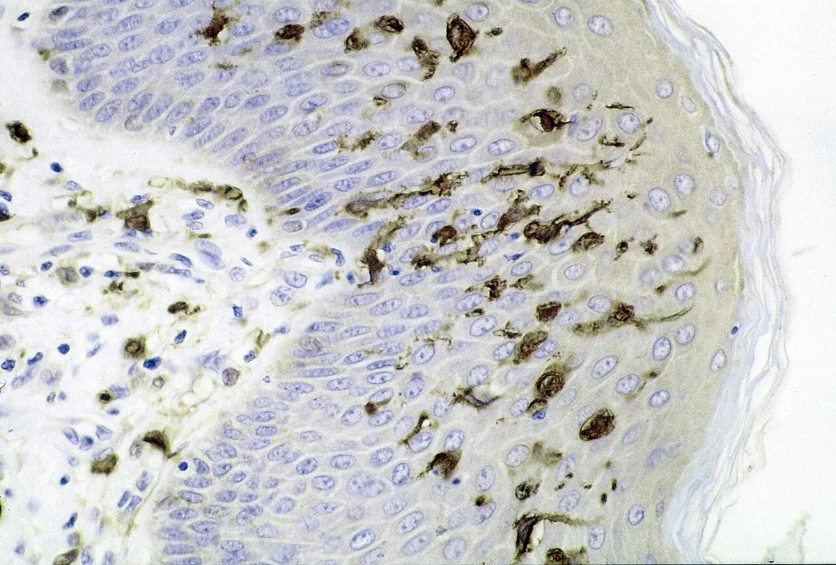 A microscope slide of skin, stained so that the cell nuclei look pale blue and some cells look dark brown, with long thin branches reaching out between the other cells