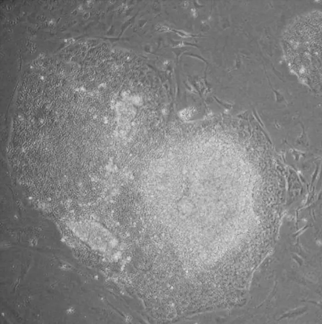 A microscope photo in gray: a large rounded clump of tightly packed small cells, surrounded by thin, stretched-out cells in the background