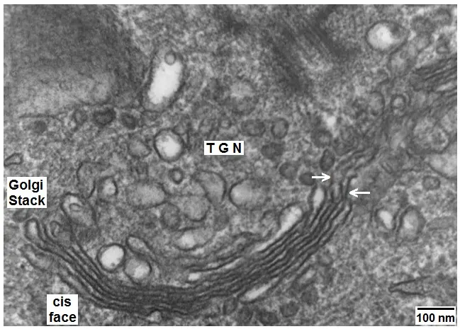 A black-and-white electron microscope picture of the inside of a cell, with a stack of thin, curved, dark parallel lines labeled Golgi stack and many small round bubbles around it