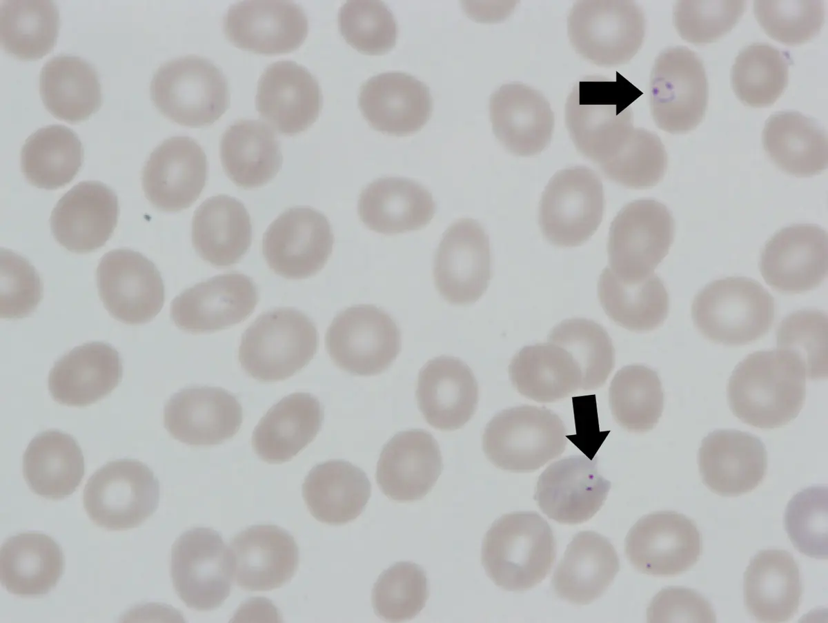 Many pale round red blood cells seen through a microscope; two black arrows point to tiny dark rings inside two of them