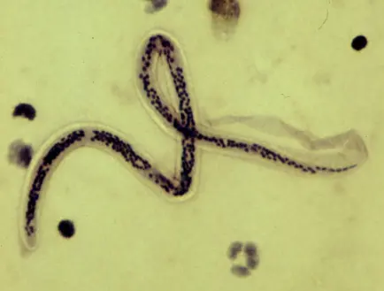 A long, thin, looping worm, its body packed with dark dots, on a pale yellow-green background under a microscope