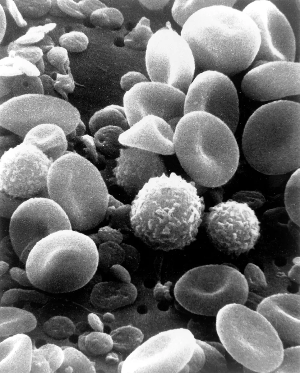 Black-and-white electron microscope picture of many smooth, round, dented discs and a few larger round cells with bumpy surfaces