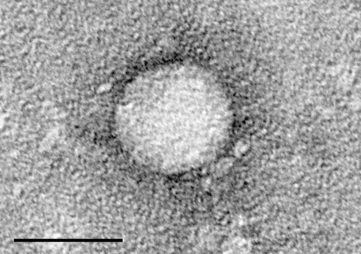 A grainy gray electron microscope picture: one pale, round particle with a darker ring around it, and a black scale bar below