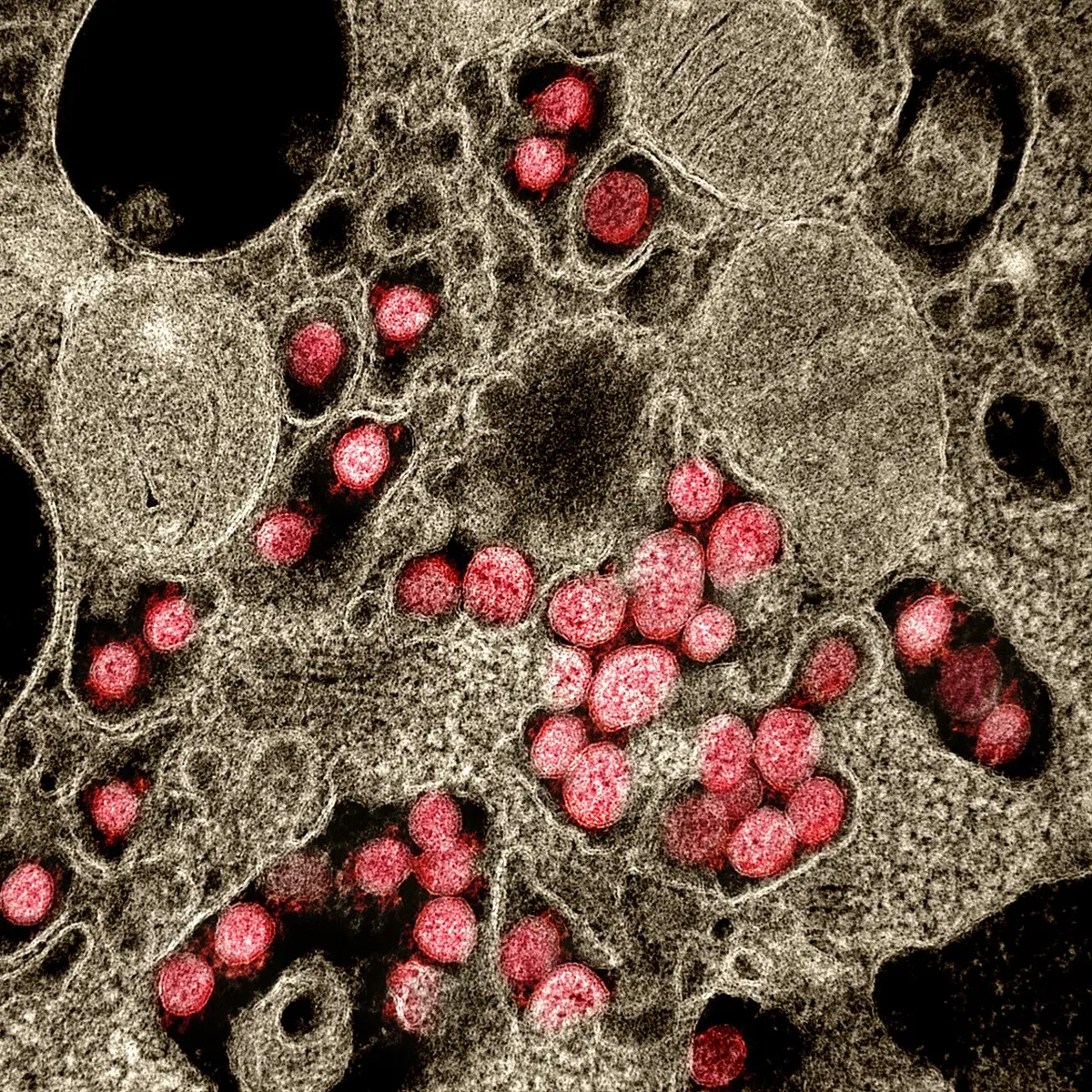 An electron microscope picture in brown and gray: the inside of a cell, crowded with many small round particles colored pink