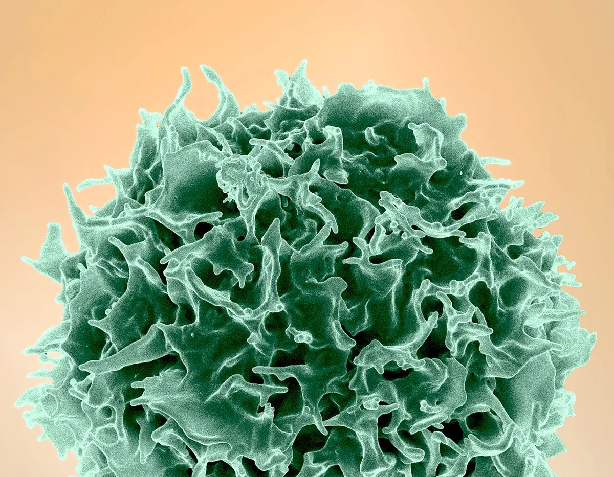 The top half of a round cell, its surface covered in crinkled folds and short fingers, colored green on a pale orange background