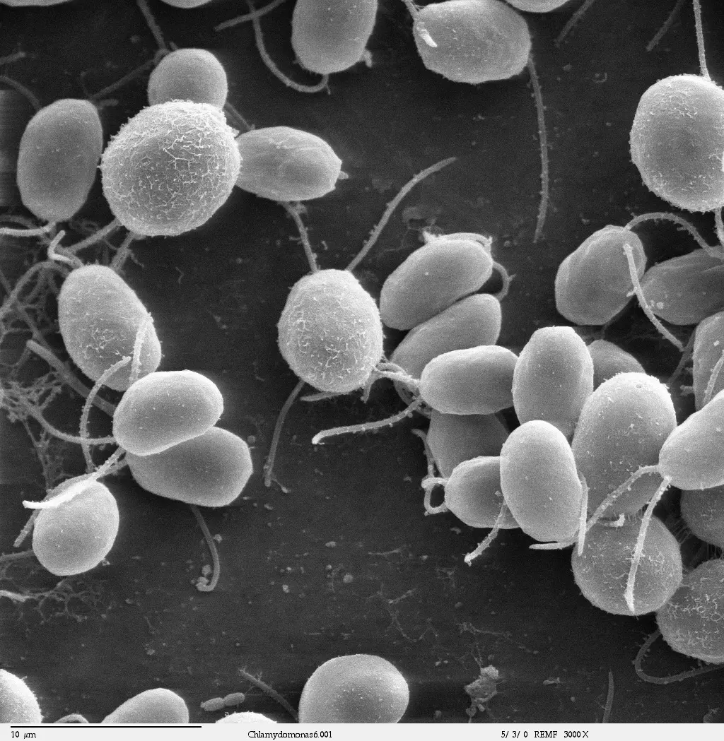 A black-and-white electron microscope picture of many smooth oval cells, each with two long thin threads coming from one end, lying on a dark surface